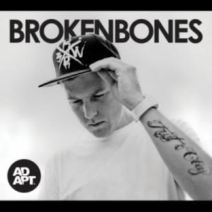Broken Bones